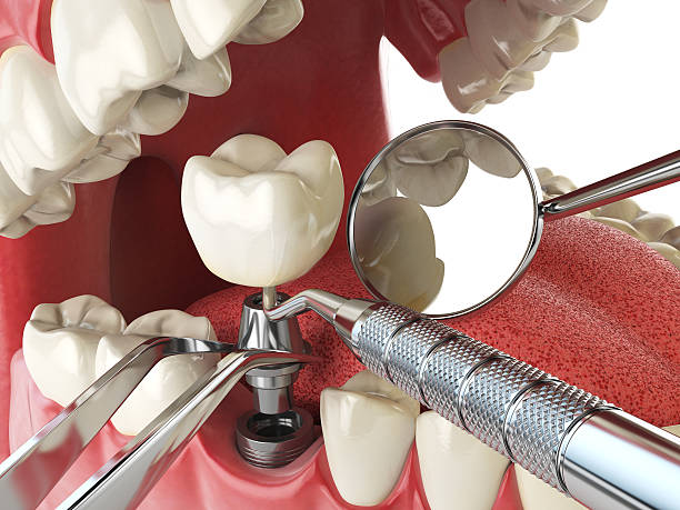 Best 24-Hour Emergency Dentist in Cartervle, IL