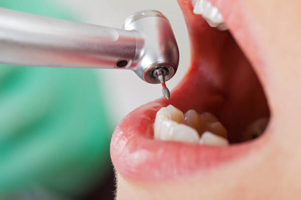 Best Mobile Emergency Dentist in Cartervle, IL